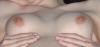 harte nippel