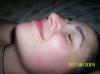 oralserie7