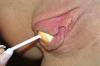 Lollipop1 Lollipop1