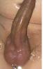 penis