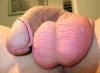 Balls