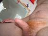 penis10